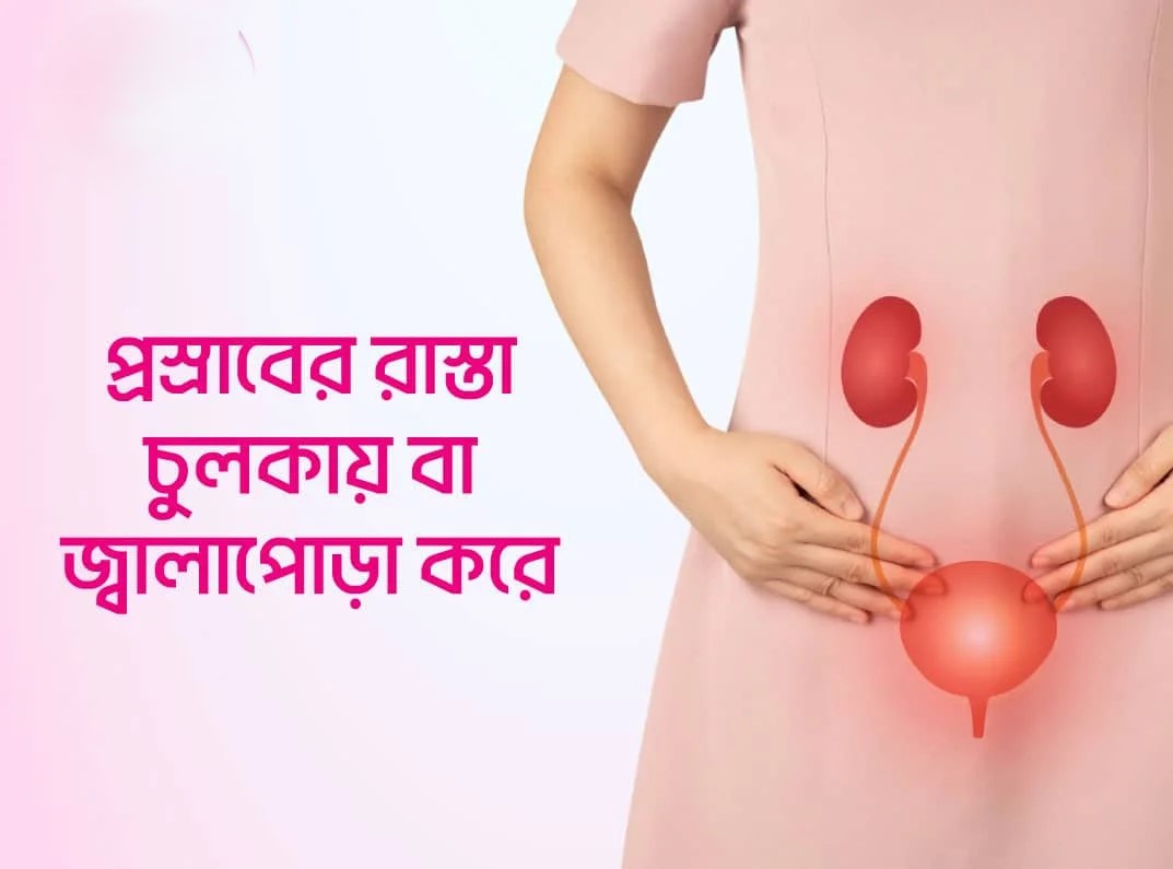 for-web-infographic-1